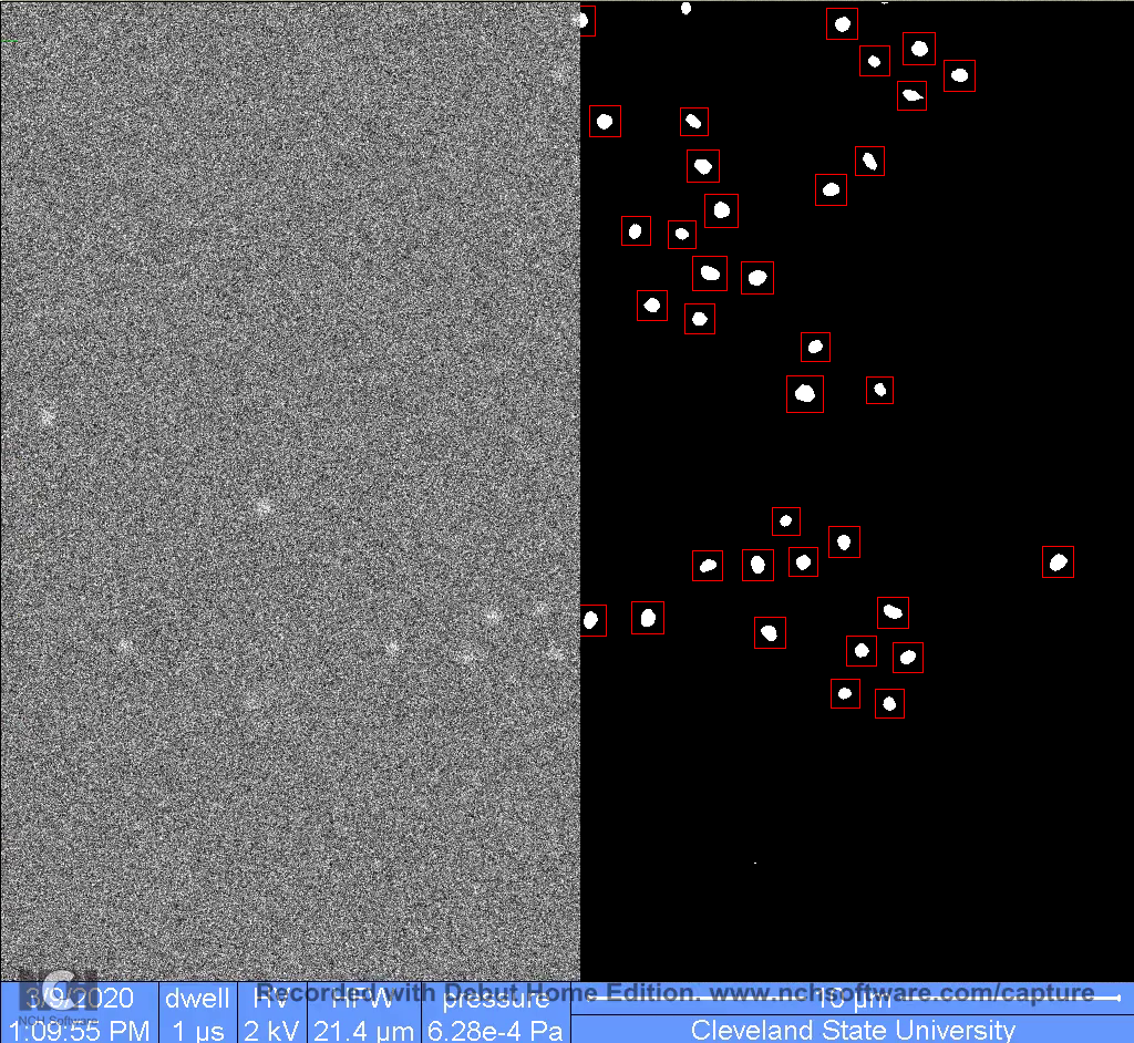Splice of electron microscope image showing how USRA Video was able to
denoise and detect polymeric microgels compared to the original image.